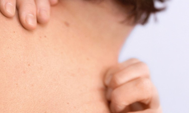 Eine Person in Nahaufnahme kratzt ihren Rücken