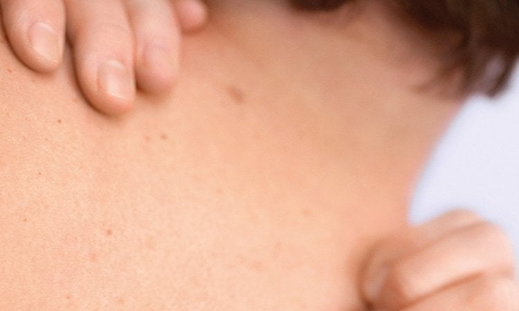 Nahaufnahme eines Gesichts auf der die Poren und Rötungen zu sehen sind