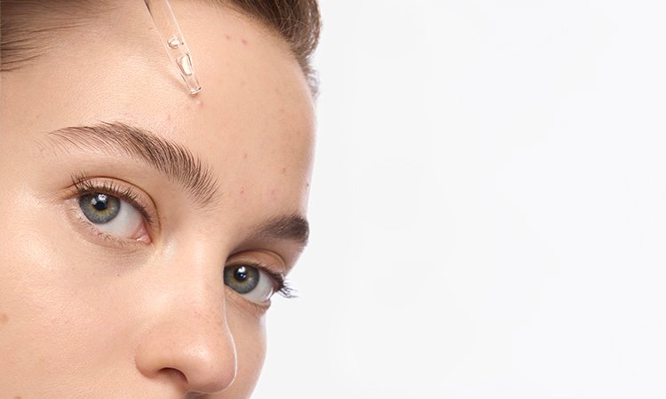 Gesichtsausschnitt einer jungen Frau mit Akne, die mit einer Pipette ein Serum aufträgt