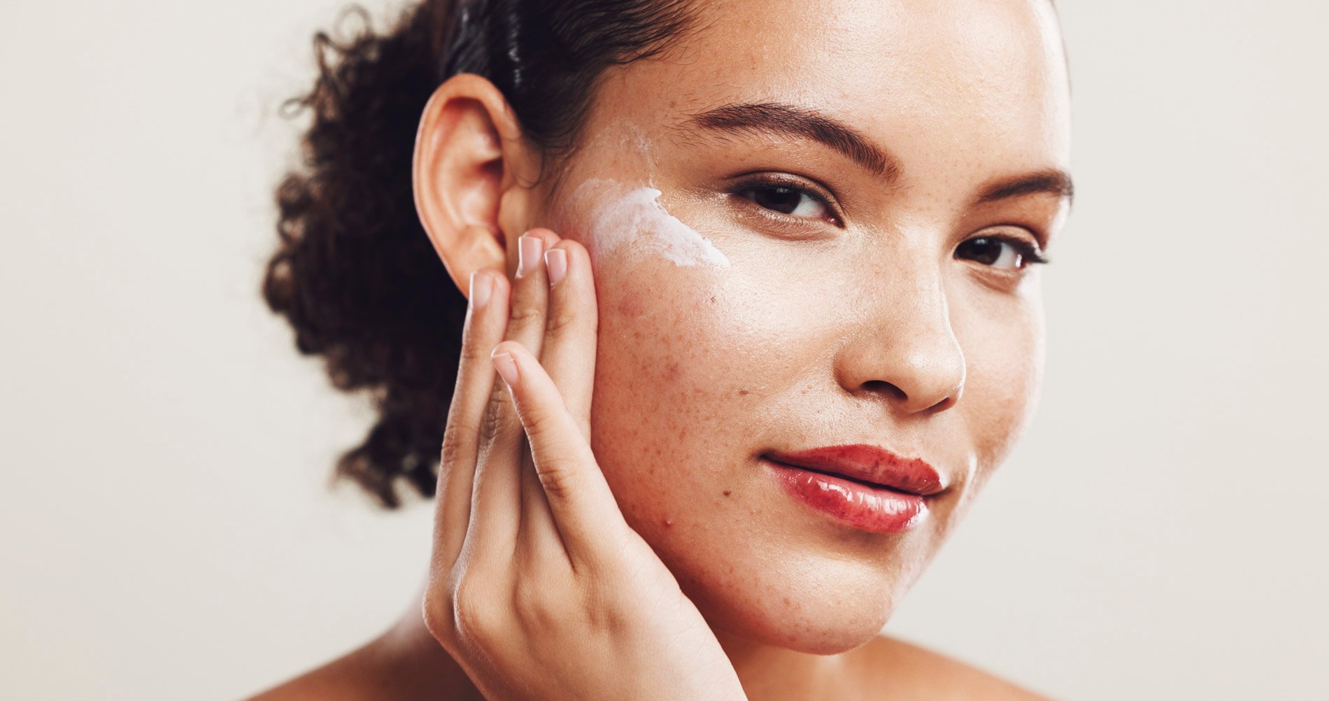 Eine Frau trägt mit leichtem Lächeln eine Creme auf ihre Gesichtshaut mit Akne auf.