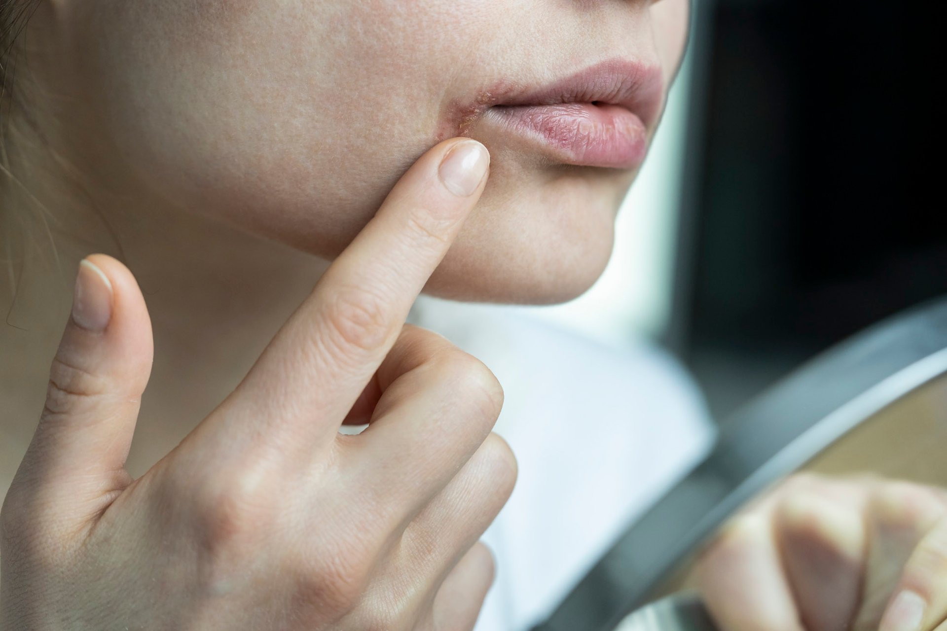 Person zeigt mit dem Finger auf eine Stelle am Mundwinkel