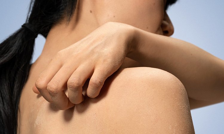 Eine Person kratzt sich mit der linken Hand an ihrer rechten Schulter