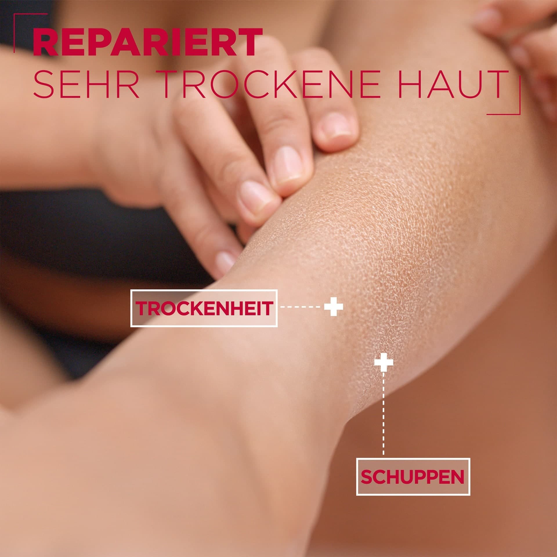 Mixa Intensiv Nährende Körpermilch – Für Trockene Haut, Mit Allantoin & Sheabutter, 400 Ml
